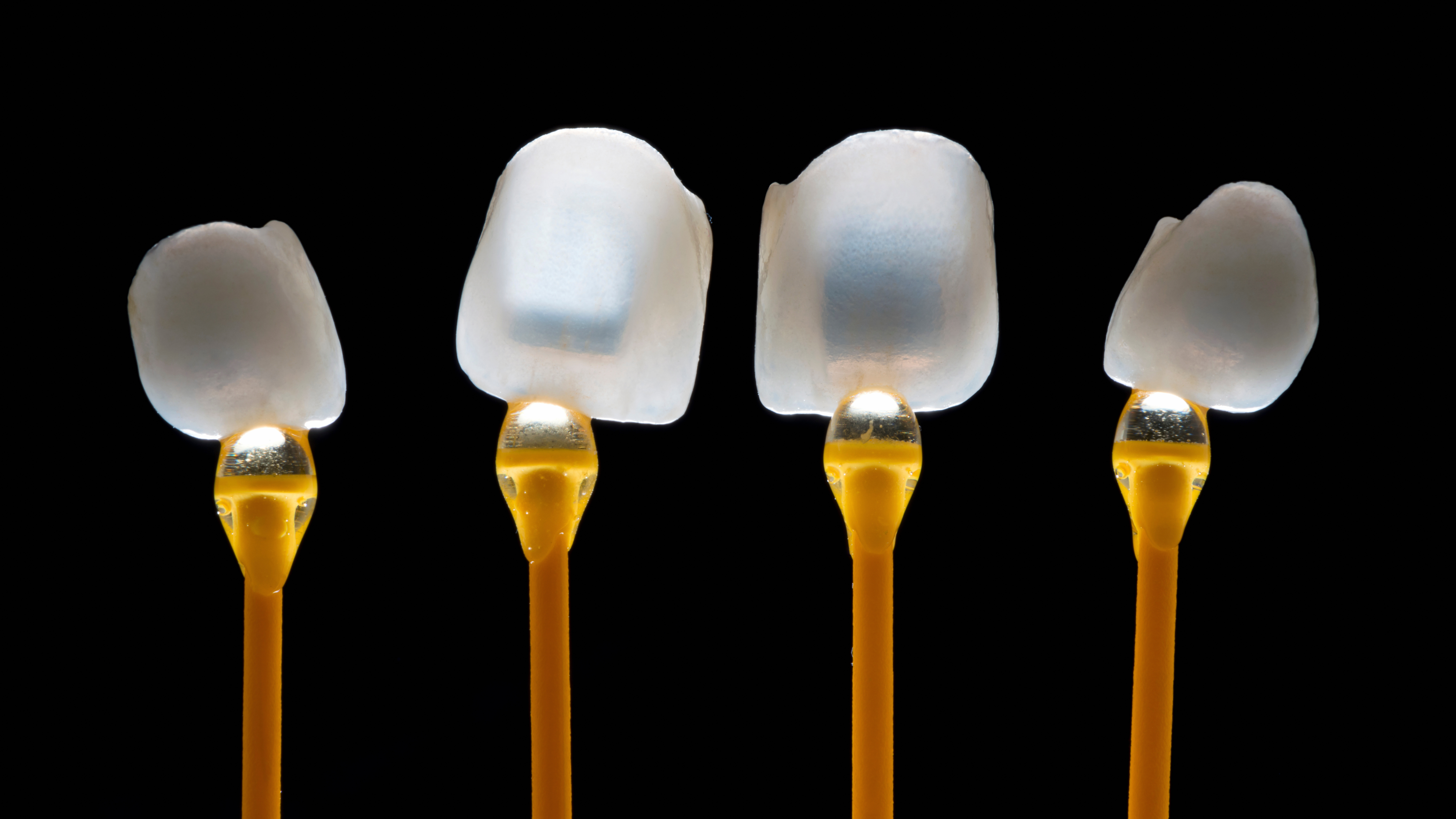 Faccette Dentali